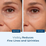 Pure Hyaluronic Acid Serum - Cosmedica Skincare