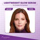 10% Niacinamide + Zinc Treatment Serum