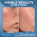 Hyaluronic Acid +Vitamin B5 Serum
